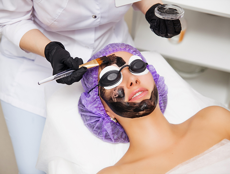 Carbon Laser Peel Treatment